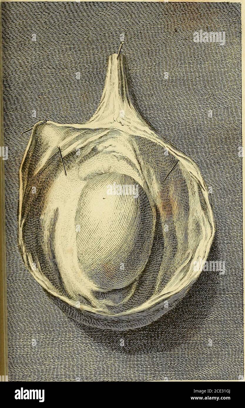 . Die chirurgischen Werke von Percivall Pott .. . erhebliche Verletzung jetzt in Sicht. Wedressed es mit Flusen, gepresst aus einem styptic, und beabsichtigte, dass Dressing tohave blieb auf für einen Tag oder zwei: Aber wir weresoon gesendet für wegen einer alarmierenden Rückfall der hesemorrhage, die so considerable gewesen war, um eine Swoon zu produzieren. Die Kastration erschien uns als die einzige Wiederholung, und sie wurde sofort ausgeführt. RECHTSSACHE XXXII. Ein MANN MITTLEREN ALTERS kam in St. Bartho-lomews Krankenhaus, und wollte, dass ich auf das Abseilen in seiner Leistengegend und oberen Teil des Crotum auf der rechten Seite zu suchen; die, Stockfoto
