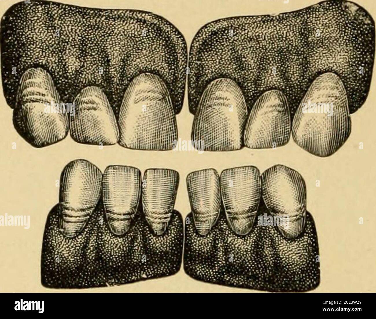 . Ein Handbuch der mechanischen Zahnheilkunde und Metallurgie . t, ihre Form und Charakter, ob die Seiten der Zähne parallel oder divergent sind; ob ihr Gesicht Fiat oder gebogen; ob sie dünn und transluzent oder dick, undurchsichtig und massiv. Zweitens, ihre Größe, das heißt, ihre Breite und Länge und therelative Breite und Länge der vorderen Zähne. Abb. 13illustriert typische Zahnfleischschnitte für die vier Basaltemperaturen. Drittens, ihr Schatten. Wo alle Zähne nicht verloren gehen, und die restlichen Zähne sind in gutem Zustand, sollte eine Mühelosis gemacht werden, um die natürlichen Zähne so genau wie 36 ME entsprechen Stockfoto