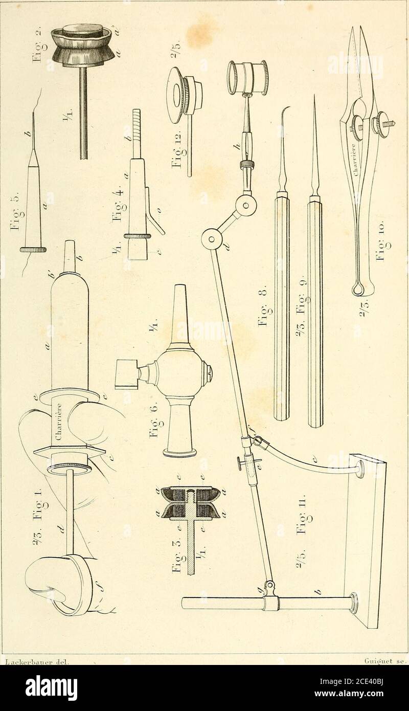 . Du microscope et des Injections : Dans leurs applications à l'anatomie et à la pathologie, suivi d'une classification des Sciences fondamentales, de celle de la biologie et de l'anatomie en particulier . dont ces deuxpièces de cuir «a sont fixées par les deux pièces solides en cuivreec et ee qui compodient la charpente du cabon. Abb. IV Forme dune canule de moyen Volume pour injectionsfines. – A Corps de la canule légèrement conique, destiné à sa-dapter sur le porte-canule (ô Abb. I.) par frottement. – h tube cy-lindrique destiné à être introduit dans le vaisseau. – o Oreilledestinée à Fixer Stockfoto