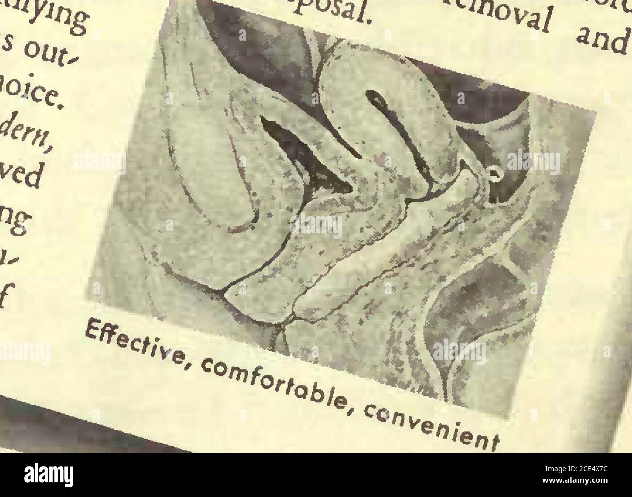 . Die kanadische Krankenschwester . /U «dff Il W^*^^^/. Bevorzugt, weil /nay 1. Aufnahme von Men-Struol-Dischorge bei Cervix uteri zulassen. 2. Beseitigen Aussicht auf Irritation. 3. Minimiie Unterwerfung zu geruchshemmenden Zersetzungsprodukten. 4. Verführen Gefahr der Infektion perinealen Ursprungs. 5. Entlasten psychologicalhazard, 6. Sorgen Sie für hygienischen schutz in seiner bequemsten, komfortablsten und hygienischsten Form. ^in tte, &gt;/./ i^al ^rtipl^^ne. 0«£§5-- ^^7, ABTEILUNG CNS2. Stockfoto