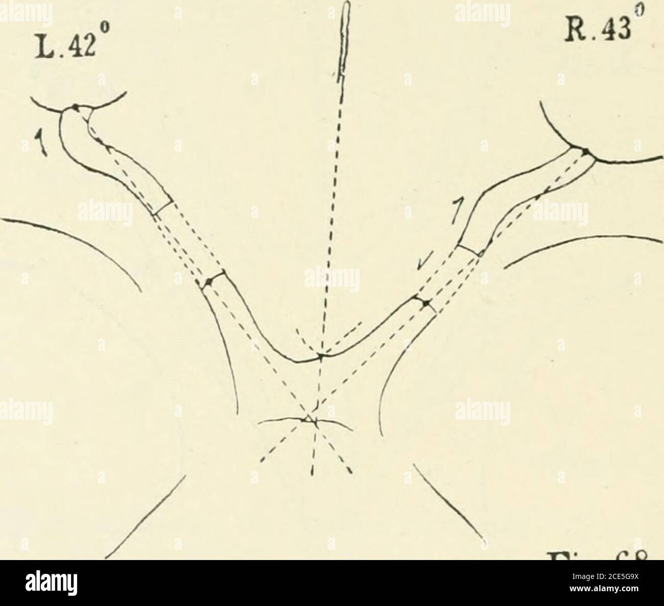 . Beiträge zur Anatomie der Orbita . Fi-67. The Shnerven. R.: Von der Verkaufsstelle stark nach aussen, dann allmahlich zum Bulbus absteigend. L.:PRST stark nach oben und aussen, dann ein wenig mehr nach innen,zuletzt wieder mehr nach aussen zum Bulbus absteigend. Bei Bewegung nach innen-unten wird rechts der Nerv aufgehoben. Durchmesser des rechten Auges c. 24,5 Mm. Q * 132 68. Fallen. L., Ludwig, 64 J., Taglöhner von S. Hydroceph. Bsp. 9. XII 85. V. 2. Sekt. 9. XII N. 2. K.-L. 1,6. Sch-B. 0,42.L. d. Opt. R.: In situ 22,5, gestr. 26, Diff. 3,5. L. d. Can. Opt. 9.L.: » » Stockfoto