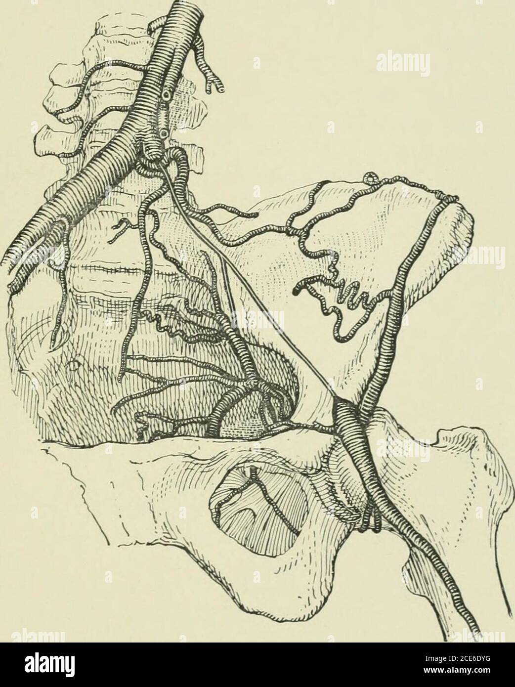 . Journal of Anatomy . epigastric und deepcircumtlex Iliac, und die proximale Hälfte der inneren Iliakarterien auf der Eftseite wurden durch faserige Schnüre dargestellt. Die A. femoralis wurde patentiert und erhielt Blut mittels Ananastomose zwischen der letzten Lendenwirbelsäule und den tiefen Zirkumflex-Arterien.die distale Hälfte der inneren Arteria iliaca wurde ebenfalls patentiert und erhielt blutV)y eine Anastomose zwischen der mittleren Sakralarterie und mehreren großen Lateralsakralarterien. Die üblichen Äste entstanden aus der inneren Arteria iliaca, außer dass die Arteria ilio-lumbale fehlte: Die Arteria obturator entstand aus t Stockfoto