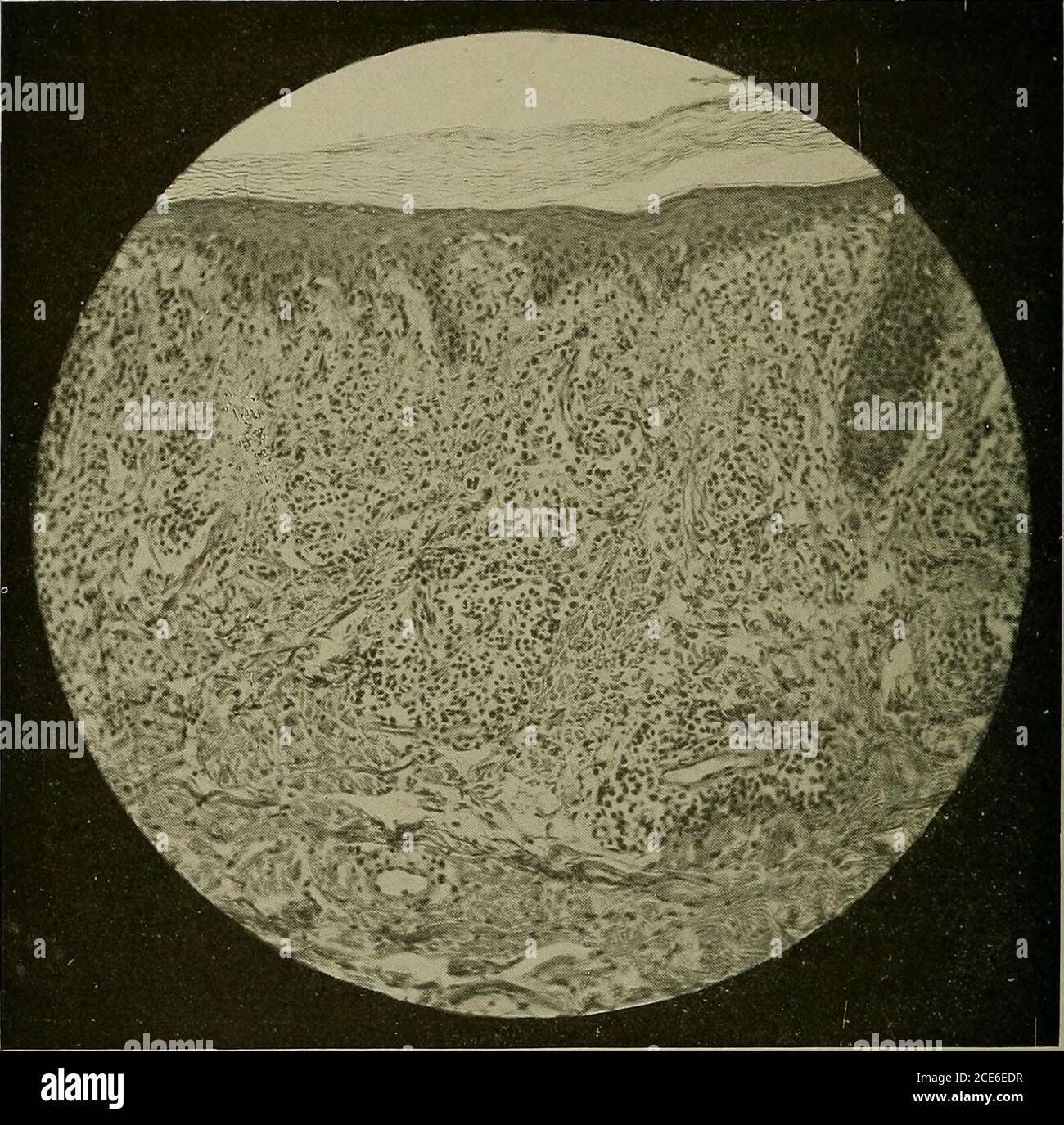 . Syphilis eine Abhandlung über Ätiologie, Pathologie, Diagnose