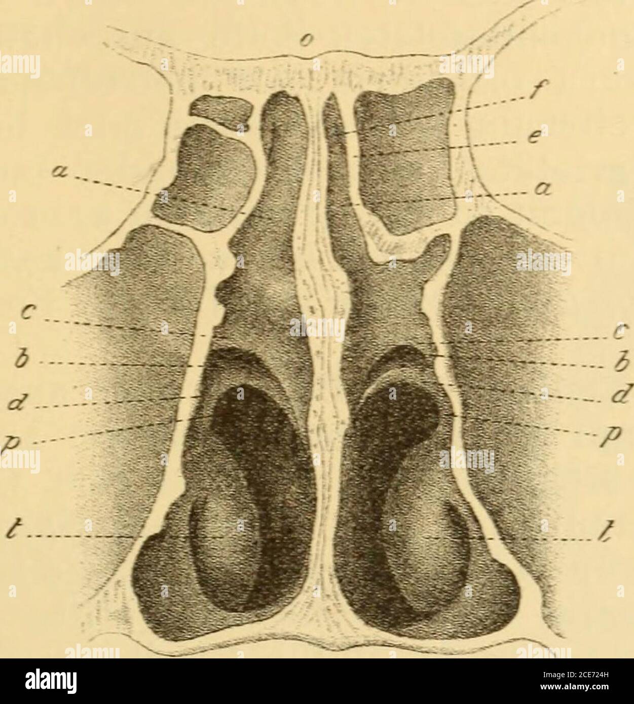 . Pathologie und Therapie der entzündlichen Erkrankungen der Nebenhöhlen der Nase . durch, dass das hintere Ende des Siebbeinesbei seiner Lagerung an die vordere Fläche des Keilbeins einesenkrechte Furche bildet, wrelche oben vom Nasenhöhlendache be-grenzts ist, Nach unten zu über den hinteren Enden der oberen undmittleren Muschel an der unteren Keilbeinhöhlenfläche in die Choanenmündet. Diese Lage des ostium sphenoidale erklärt es, warum patho-logisches Secret der Keilbeinhöhle so häufig in den Nasenrachenraumgeleit wird. Constant is the Lage des ostium sphenoidale only insofern, alses im Stockfoto