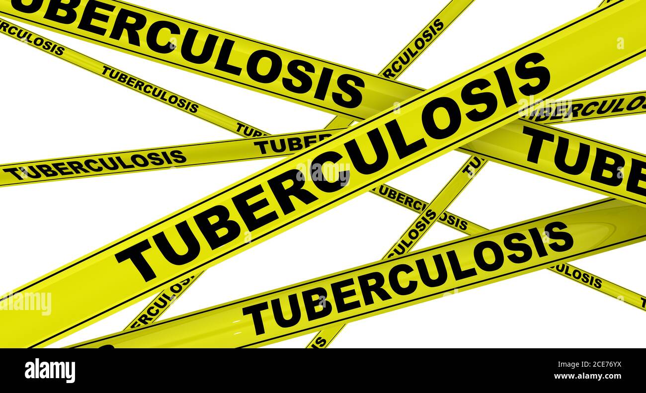 Gelbe Warnbänder mit schwarzen Worten TUBERKULOSE (ist eine Infektionskrankheit, die normalerweise durch Mycobacterium tuberculosis-Bakterien verursacht wird). Isoliert Stockfoto