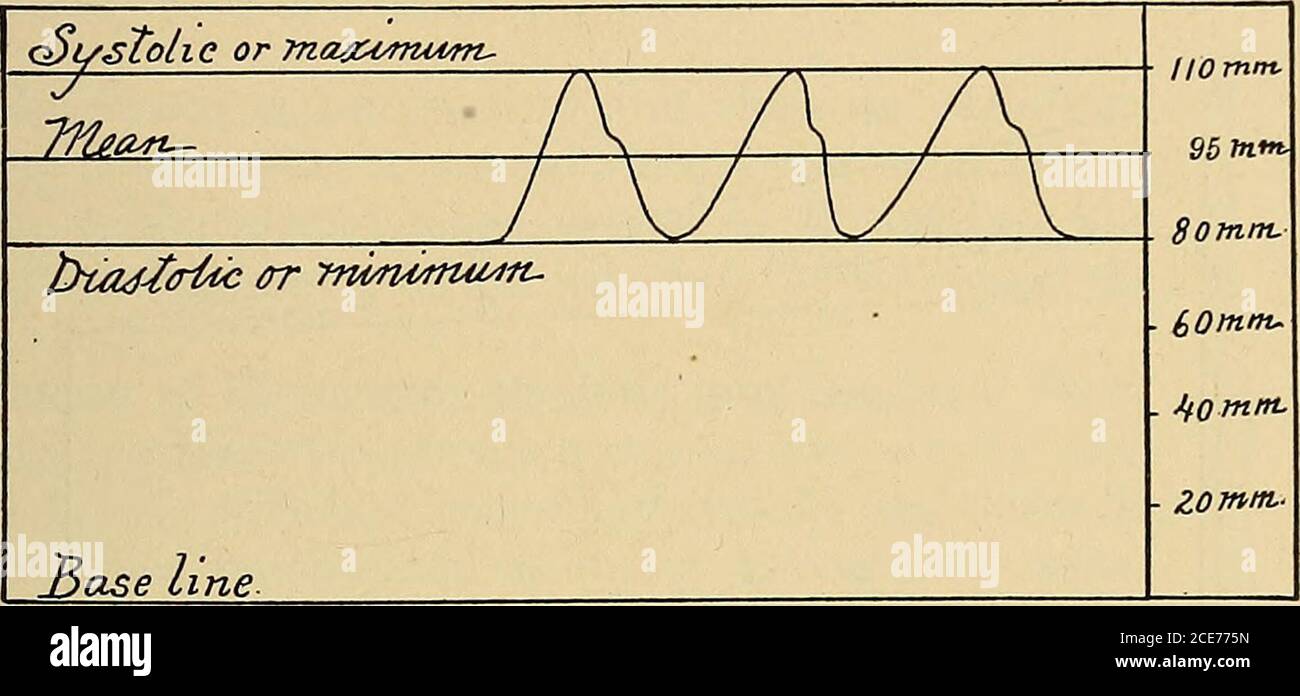 . Ein Textbuch der Physiologie : für Medizinstudenten und Ärzte . essure in den großen Arterien, wie durch GESCHWINDIGKEIT UND DRUCK DES BLUTFLUSSES beeinflusst. 493 das Herz schlug. Diese Arterien unterliegen in der Tat sehr schnellen und sehr umfangreichen Veränderungen des Drucks bei jedem Herzschlag, und diese Veränderungen sind natürlich stärker ausgeprägt, wenn die Kraft des Herzschlags erhöht wird, zum Beispiel 1 y Muskelübung. Systolischer, diastolischer und mittlerer arterieller Druck. – wie im letzten Absatz beschrieben, unterliegt der arterielle Druck in den größeren Arterienmit jedem Herzschlag umfangreichen Schwankungen. Der Stockfoto