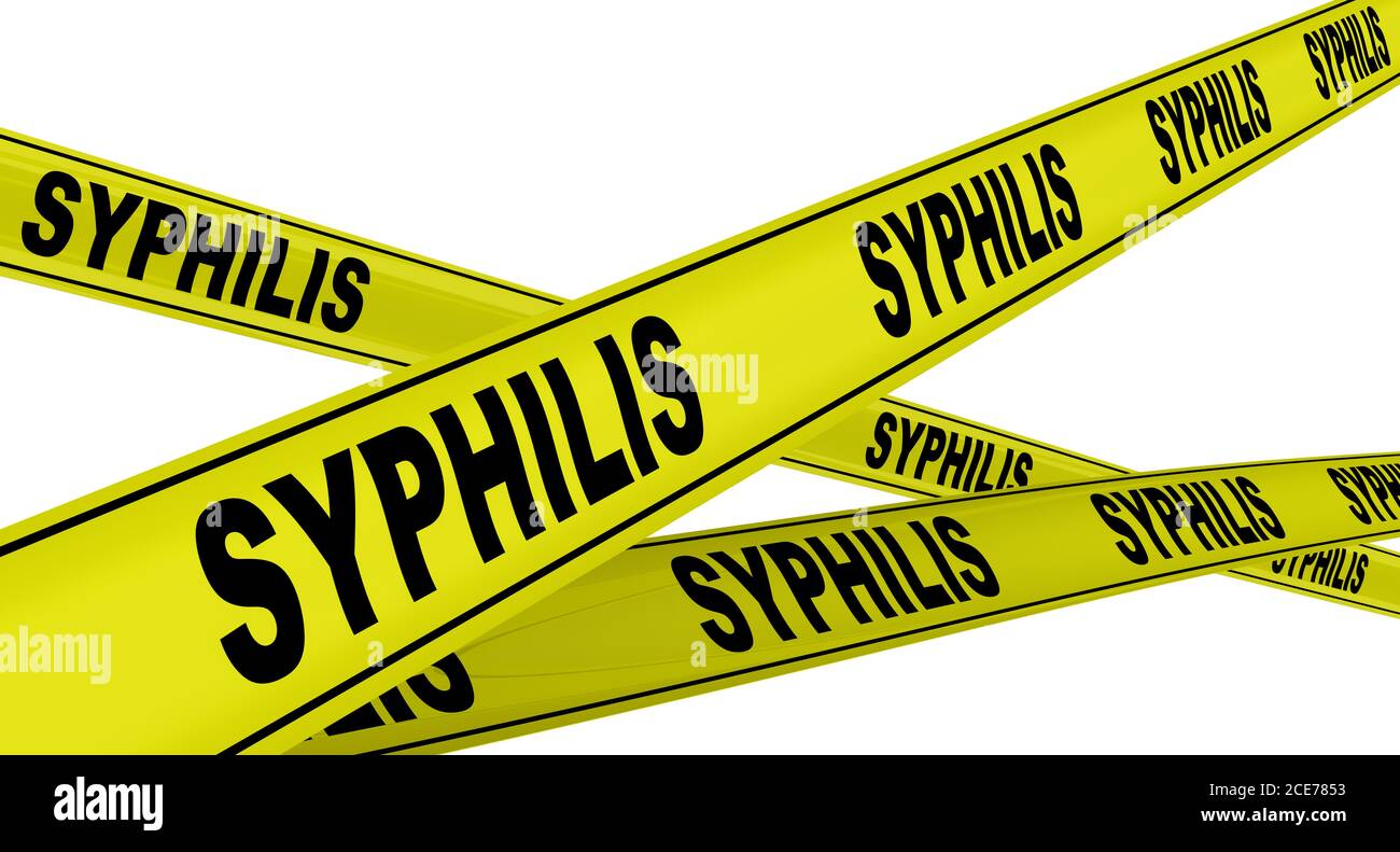 Syphilis. Gelbe Warnbänder mit schwarzen Wörtern SYPHILIS. Isoliert. 3D-Illustration Stockfoto