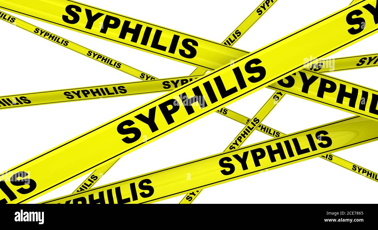 Syphilis. Gelbe Warnbänder mit schwarzen Wörtern SYPHILIS. Isoliert. 3D-Illustration Stockfoto