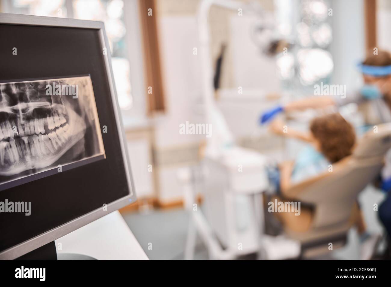 Die zahnärztliche Behandlung erfordert eine Röntgenaufnahme des Kiefers Stockfoto