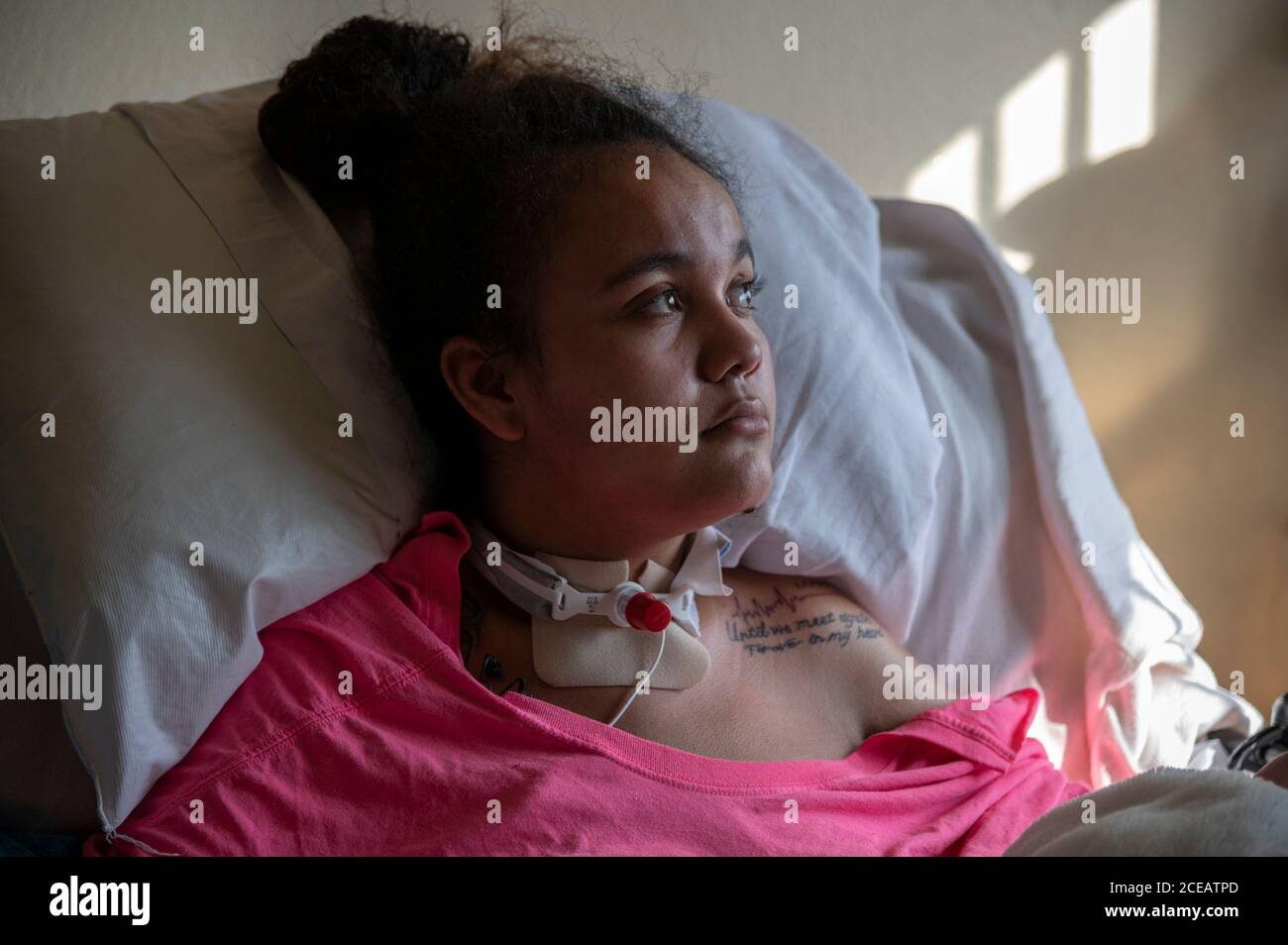Sacramento, Kalifornien, USA. Februar 2020. Felicia Brent-Velasquez, 18, sitzt im Februar in einem Krankenhausbett, während sie sich zu Hause von einem Autounfall erholt, bei dem sie eine Quadriplegikerin hinterlassen hat. Vor dem Unfall, als sie eine Bewohnerin des Kinderempfangsheims von Sacramento war, sagte sie, dass sie nur die Sicherheitskräfte bitten müsse, das Tor zu öffnen und sie würde direkt aus dem Haus gehen und ins AWOL gehen. Sie hat ein Tattoo auf ihrer Schulter für einen Jungen, mit dem sie in einer Beziehung war und der in Southside Park starb. Seine eingeschrieben mit einem Leben Puls schlagen, seinen Tag des Vergehens, und die Worte "bis wir uns wieder für immer Stockfoto
