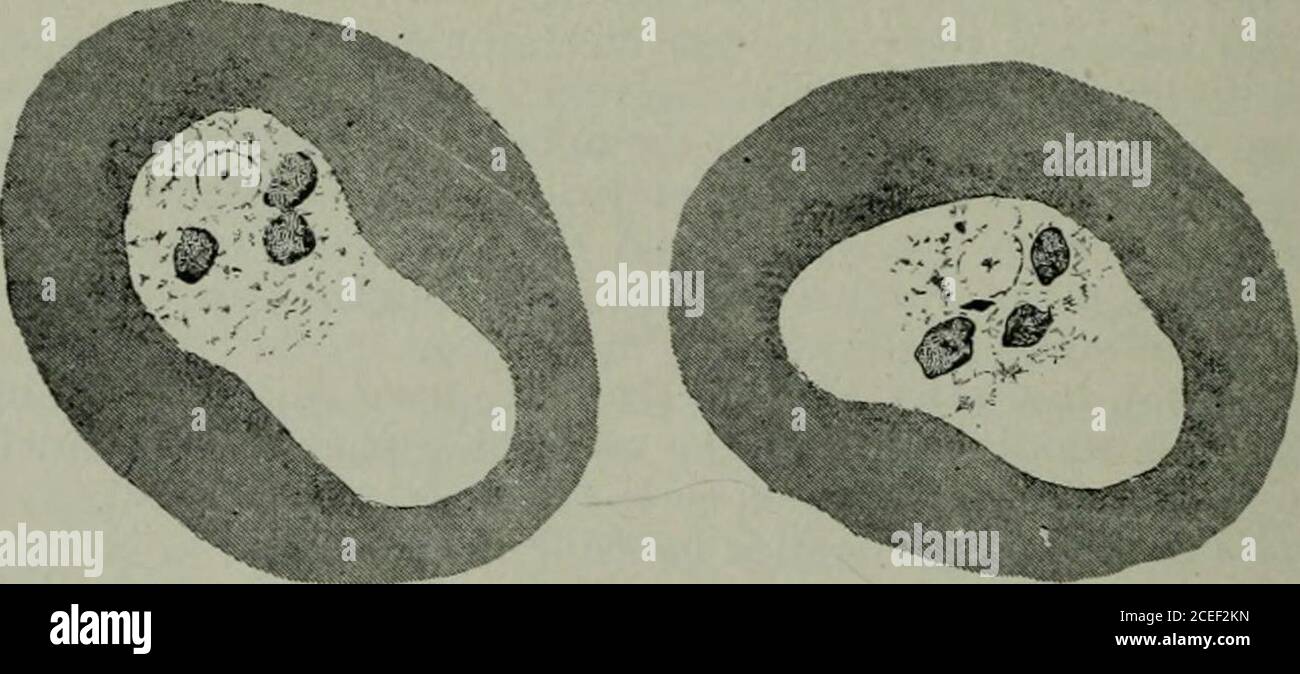 . Pathogene Mikroorganismen, einschließlich Bakterien und Protozoen; ein praktisches Handbuch für Studenten, Ärzte und Gesundheitsbeauftragte. isms, die für das Wachstum der Aamebse geeignet sind, begleiten sie und auf diese Weise kann man die Aamebse schließlich mit einem bestimmten Bakterium wachsen lassen. Wir haben aus einer Kultur eine einzelne Ameba ohne Bakterienbegleitung durch die folgende einfache Methode isoliert: Unter der Low-Power-Linse mit einer feinen Platinschleife wird eine iso-latierte Ameba an den Rand der Agarplatte gezogen. Wenn es gut sepa-bewertet ist, wird eine Scheibe des Agars, das es enthält, heraus nach dem Rand des ob-jektiven geschnitten und ist tra Stockfoto