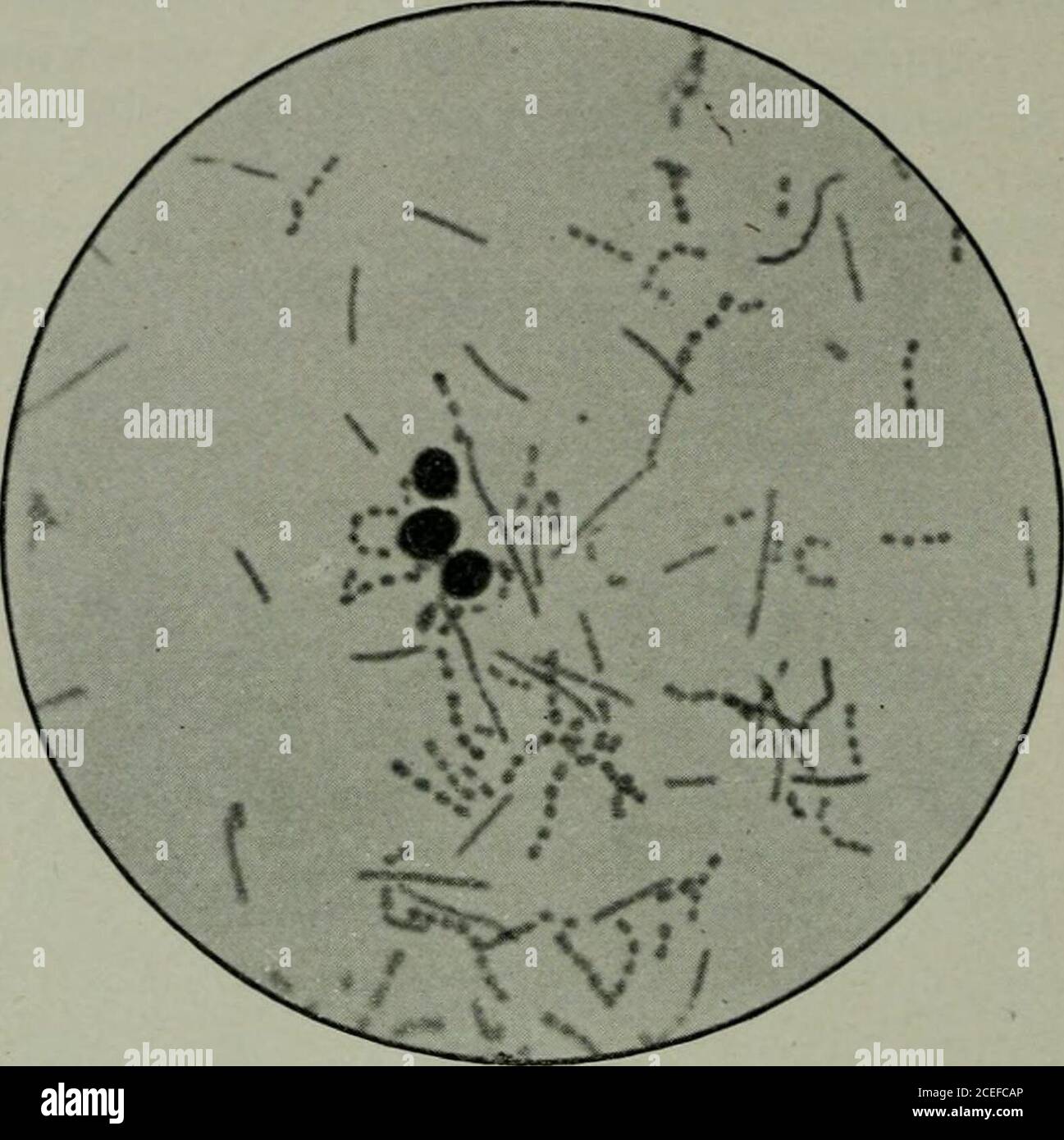 . Pathogene Mikroorganismen, einschließlich Bakterien und Protozoen; ein praktisches Handbuch für Studenten, Ärzte und Gesundheitsbeauftragte. Erhitzte Milch die gleiche Bac-Terie wie in Maadzoun vorkommen. Yohoud, blabberade, und andere saure Milch werden durch die Verwendung vonmuch die gleichen Organismen hergestellt. Die Bazillen sind derzeit am meisten interessant sind diejenigen, die den B.bulgaricus (B. von Massol), die in der östlichen Milch vorhanden sind und sind jetzt durch die Befürwortung von Metchnikoff allein oder in Verbindung mit einer Milchsäure Streptokokken verwendet, um viel von der Tschindung der Milch von Europa und Amerika zu produzieren. In H)()(t, Cohendy studierte Stockfoto