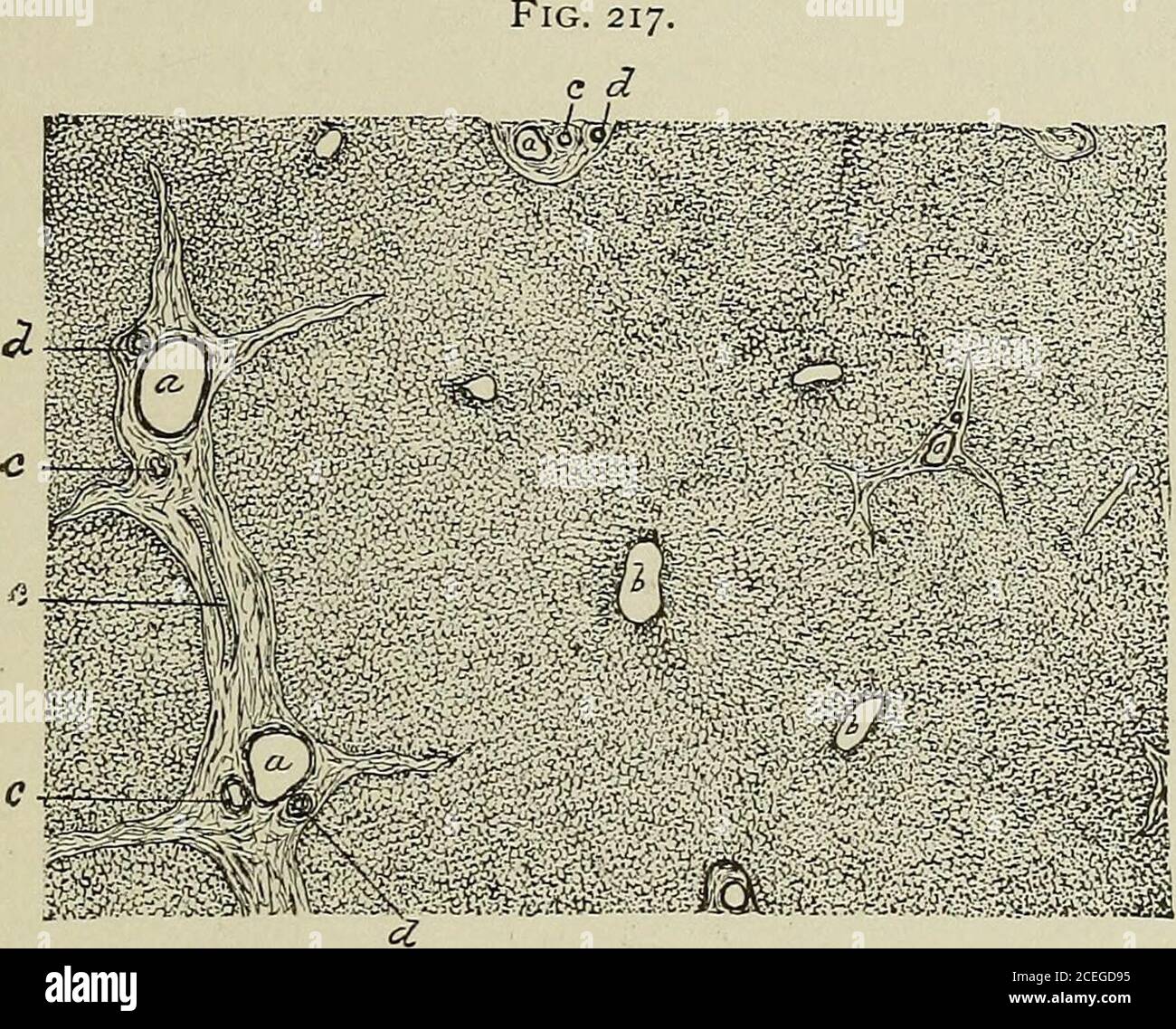 . Textbuch der normalen Histologie: Einschließlich einer Darstellung der Entwicklung des Gewebes und der Organe. Y der Blutgefäße und der Thelobeln: A, interlobuläres Bindegewebe ; ^, f, Zweige von por- , ■. J <. T!, ] Vena Tal und der Leberarterie ; ^, Gallengänge ; ^, Vena intralobularis. UUC – UUCtS. 1 die Entmarkation der indi-vidualen Lobeln hängt von der Entwicklung dieses interlobularen Bindegewebes ab, bekannt als die Kapsel von Glisson; wenn sie sich wie in der Leber des Schweins entwickelt haben, werden die Lobeln mit großer Unterscheidbarkeit definiert, vollständig umschlossen und von ihren getrennt Stockfoto