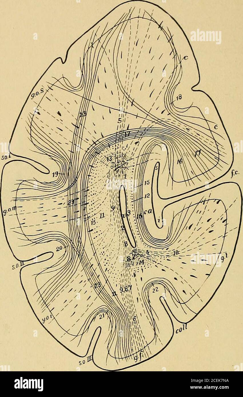 . Eine Abhandlung über nervöse und psychische Erkrankungen, für Studenten und Praktiker der Medizin. Zusätzliche Commissure, unc. Haken der hakenförmigen Faltung oder Gyrus uncinatus. Sp. Septum pellucidum. Th. Optictalamus, f.d. Absteigende Fornix, m. Corpus medullare. f.a. Aufsteigend fornix.Q. Corpora quadrigemina. A. Aquädukt von Sylvius. Pv. Pulvinar des optischen Thalamus.Gi. Innerer Genikulatkörper. T. Tegmentum. Pd. PES von crura cerebri. St.i. In-ternal Stift des optischen Thalamus. Lp. Posteriore longitudinale Fasciculus, Co.Conarium. Es muss eine mehr oder weniger weit verbreitete Erkrankung des Cortex involvinga geben Stockfoto