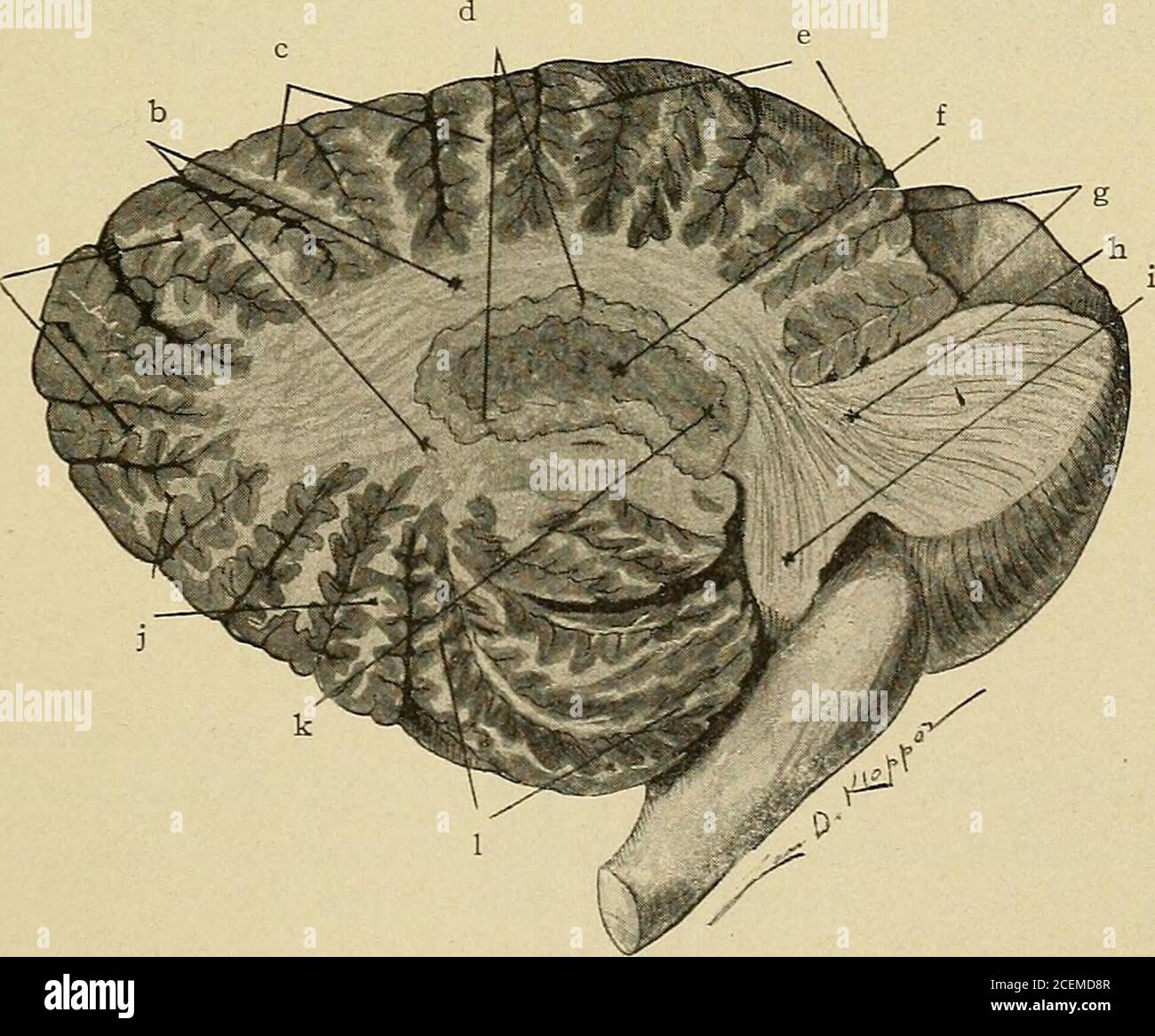 . Erkrankungen des Nervensystems : für den Hausarzt und Studenten. Abb. 37. – Median Section of Cerebellum, Pons and Medulla. (Santee) a. Predeclivil sulcus, B. Arbor vita?, c. Dekreve monticuli. d. Postdeclivil sulcus, e.Folium vermis. /. Horizontaler Sulcus, g. Knollenvermis. /;. Postpyramidensulcus, i.Pyramid, j. Prepyramidaler Sulcus, k. Uvula. I. Cummen monticuli. m. Postzentralem Sulcus.n. Zentral gelegenes Hotel. 0. Inferiorer Colliculus of corp. quad. P. Cerebral Aqueduct, q. Precentralsulcus, r. Superior medullary velum, s. Lingula. t. Mediales longitudinales Bündel, u. Fasti-gium. v. inferior med Stockfoto