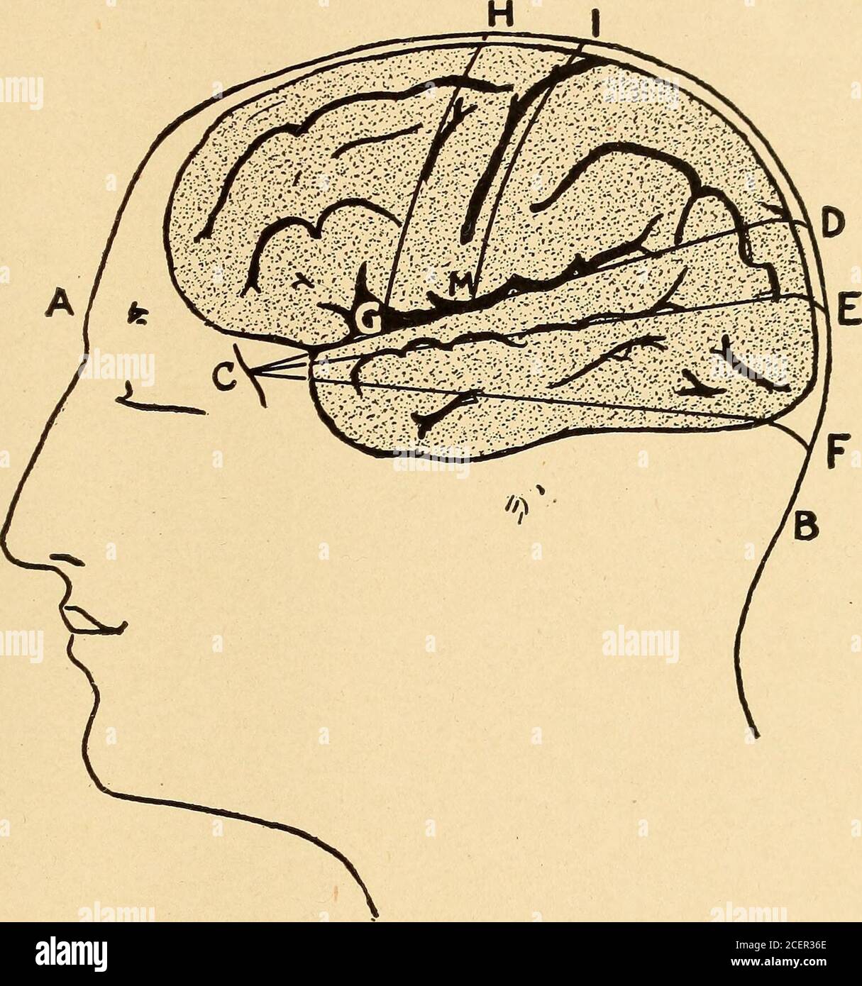 . Erkrankungen des Ohres; ein Lehrbuch für Praktizierende und Medizinstudenten. PLATTE XIII B.. Cranio-zerebrale Topographie. (Chipault.) • in dieser Platte IST A die Nasenträgung und B die Hinterhauptaushöhlenaushöhlenheit. C ist der retro-orbitale Tuberkel. Auf der Linie ab ist H ein Punkt .45 die Länge dieser Linie, I. 55, D .70, E .80 und F .95 die Länge dieser Linie. Von C werden drei Linien gezeichnet Tod, E und F, beziehungsweise. G ist ein Punkt .2 die Länge der Zeile CD, und M ist ein Punkt.3 die Länge der Zeile CD. Wenn die Punkte H und G verbunden sind, haben wir die vorRO-landische Linie, und wenn M und 7 verbunden sind, wir Stockfoto