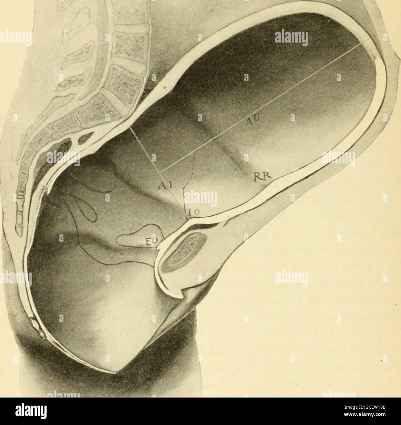 . Ein amerikanisches Textbuch der Geburtshilfe. Für Praktizierende und Studenten. Ectly posterior, direkt anterior, links transversal und rechts trans-versal. Es wird nun jedoch festgehalten, dass diese Positionen unter normalen Bedingungen nicht unnormale Pelfe auftreten. Da sie nur in einigen Sorten deformierter Pelfe und in anderen pathologischen Bedingungen gefunden werden, wird ihre Betrachtung jetzt allgemein auf den Bereich der Pathologie verwiesen. J Dextro. 388 AMERIKANISCHES TEXTBUCH DER GEBURTSHILFE. Anatomie des Beckens. Die Anatomie der Knochen und der Weichteile, die zusammen das Becken bilden, wird ausführlich in beschrieben Stockfoto