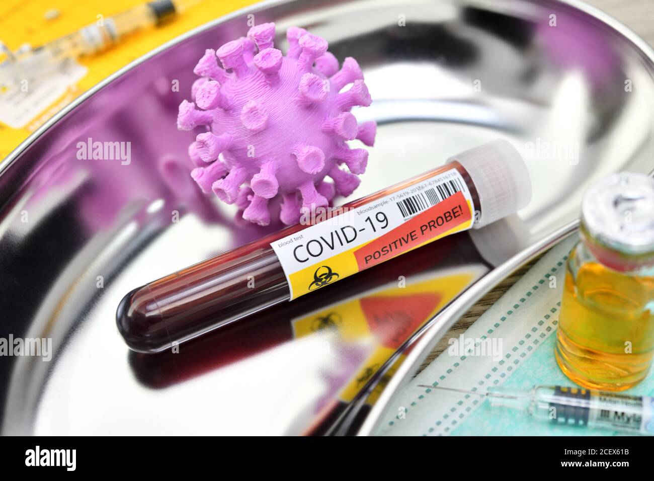 COVID-19 Blutabnahmeröhrchen und Coronavirus-Modell in einer Nierenschale, Corona-Impfung Stockfoto