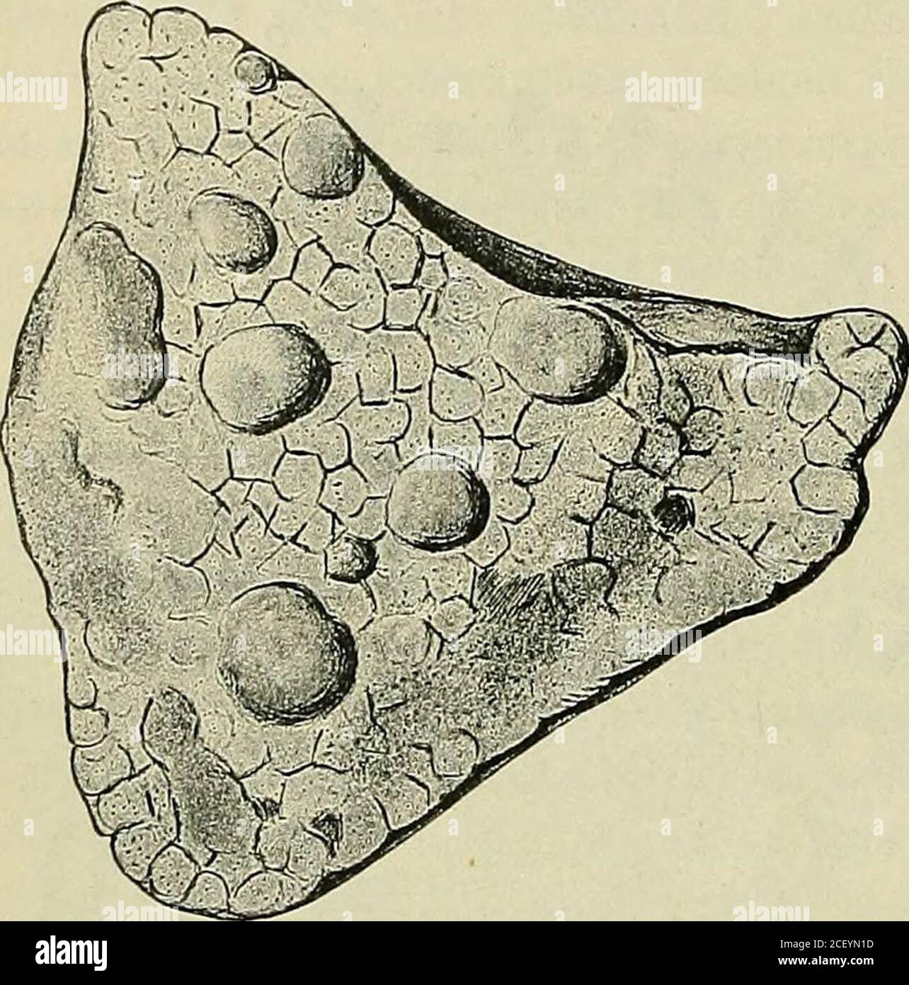 . Lehrbuch der speziellen pathologischen Anatomie für Studierende und Ärzte. alen, als auch desinterlobulären und interalveolärenBindegrees. Es scheint ein großer Reichtum an spiudeligenund polygonalen Zellen (Fibroblasten)oder faseriges, mehr oder weniger Spindelzellreiches Bindegrebe (ältereVeränderungen) vor. Zuletzt trifft vor allem die Blutgefälle; trifft die mächtige, faserige Verdickungsselbst kleiner Arterien auf (Abb. L 156,158, S. Sehr verschiedene verhaltensobere, die Alveolen. Is the interstitielle Wucherung stark, so See we an vollkommenes Vorherrschen vonzellre Stockfoto