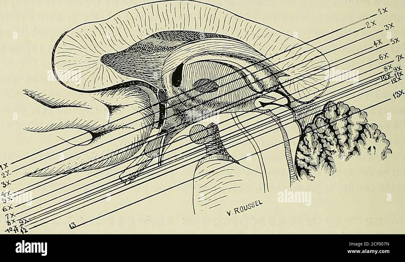 . Anatomie des centres nerveux. o-lenticulaire de la capsule interne est encore intéressé dans sa régionthalamique ou sous-thalamique. 632 ANATOMIE DES CENTERS NERVEUX. Coupé Nr. 1 x (Abb. 316), passant par la ligne 1 x de la Figur 315. Cette coupé sectionne la Partie inférieure de la commissure antérieure (coa), la commissure molle (com) et le tsenia thalami (tth.) Cette coupé intéresse la région thalamigue de la capsule interne au Niveau deses limites avec la région sous-thalamique. Elle correspondor, en arrière, à la Coupén 7 (flg. 306) de la série précédente, et en avant à la Coupé Nr. 9 (Abb. Stockfoto