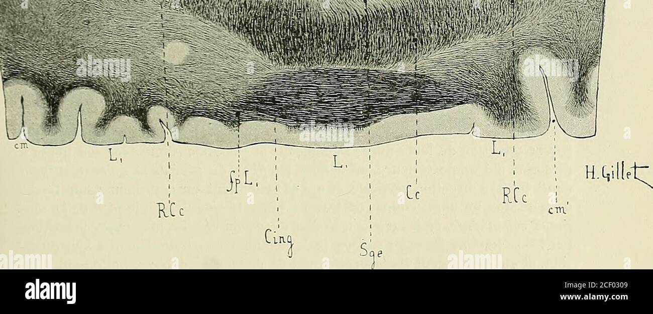 . Anatomie des Centers nerveux. : - s. Abb. 300. – Coupe horizontal microscopique, Nr. 1, passant par la ligne 1 de lafigure 299. Méthode de weigert. 2/1 Erhabenheit Natur. Détails dessinés à un gros-sissement de 12 diamètres. Die Coupés de cette série ont été pratiquées sur un hémi-sphère gauche. Cette Coupe passe à la même hauteur que la Coupe macroscopique dela Figur 219. CE, Corps calleux. - Lichtbogen, Cingulum. - cm, sillon calloso-marginal. - cm, Partie verti-cale du sillon calloso-marginal. - FI, F3, deuxième et troisième circonvolutions frontales. – Fi, FT- Premier und deuxième Sillons Stockfoto