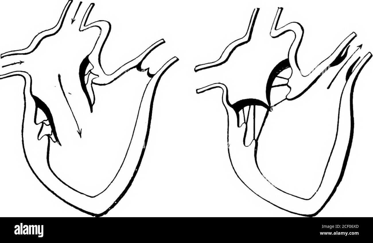 . Menschliche Physiologie. Für Bequemlichkeit in dieser Periode sofort folgt die Kontraktion der Ventrikel, und während der das Herz ist passiv. Die Hohlräume erweitern sich nun, und das Blut fließt frei von der Vena Cava und den Lungenvenen in die rechte und linke BLUTGEFÄSSE UND ZIRKULATION 133 Ohrmuscheln beziehungsweise, und von dort in die Ventrikel. Aber da Theaurikel mehr empfangen, als gleichzeitig in die Ventrikel geht, werden die Theaurikel vollständig aufgedehntwerden. Sie ziehen sich dann gleichzeitig zusammen, jeder zwingt seinen Inhalt in den Ventrikel darunter, die Kraft dieser Kontraktion ist nicht suff Stockfoto