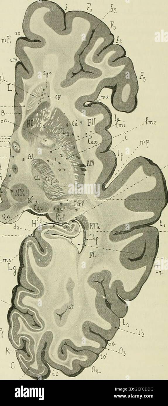 . Anatomie des Centers nerveux. E de Henle. Elle intéresse la première circonvo-lution limbique (Lj), en particulier le carrefour olfactif de Broca (CB), contourneensuite le sillon calloso-marginal (cm) et le sillon sus-orbitaire de Broca (so), etforme lécorce de la face interne de la première circonvolution frontale (MFJ). Lécorce de la face externe du lobe frontal est divisée en deux parties par unsillon profond, le sillon en H, sillon triradié ou troisième sillon frontal (f3); la 27 418 ANATOMIE DES CENTERS Nerv. F, _Ji .h i V H.Çillei Abb. 229. – Coupe horizontal de lhémisphère droi Stockfoto