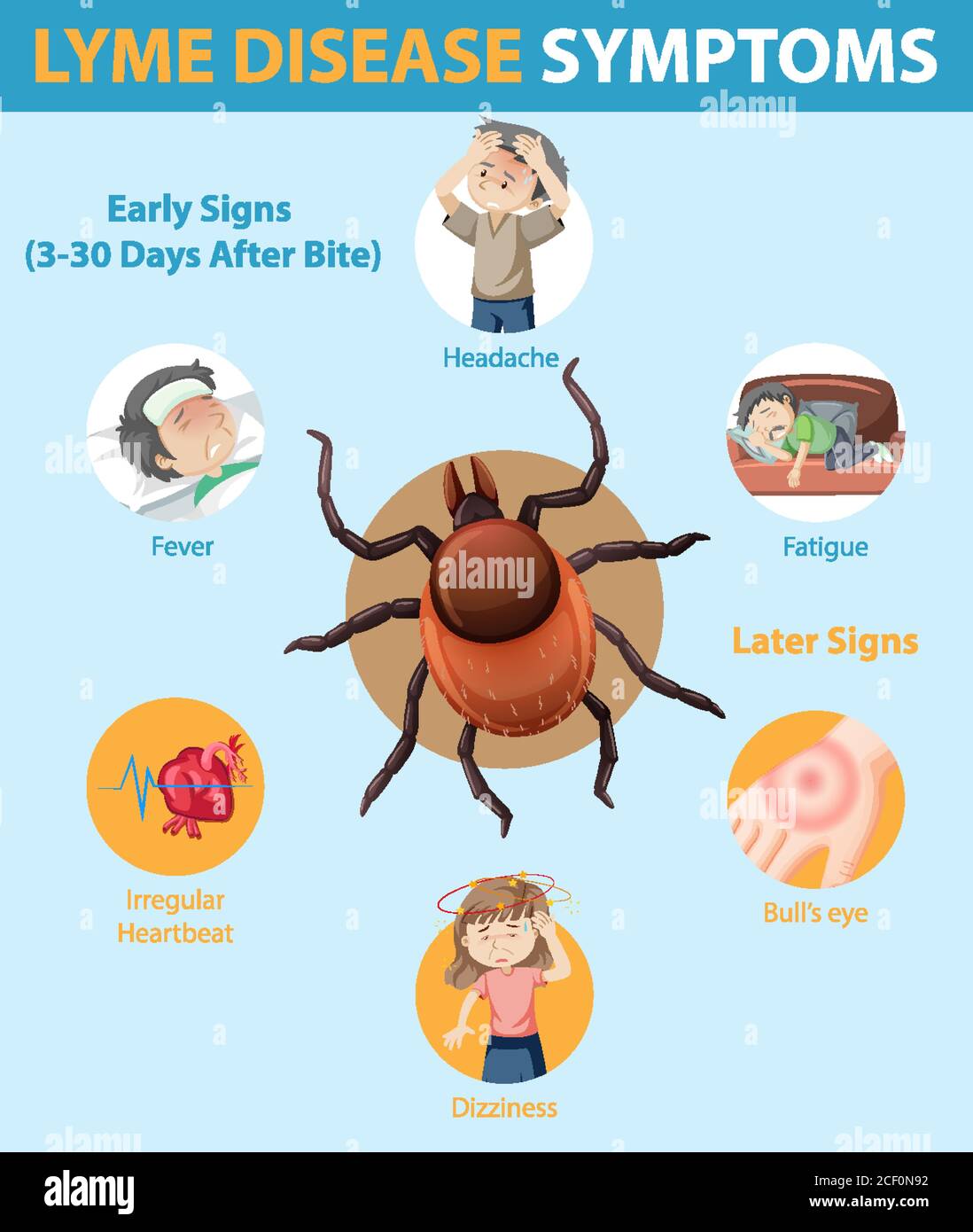 Lyme-Borreliose Symptome Informationen Infografik Illustration Stock Vektor
