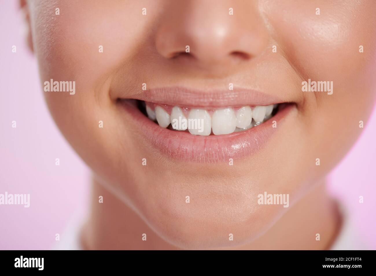 Saubere weiße Frau Zähne in breiten Lächeln Nahaufnahme Stockfoto