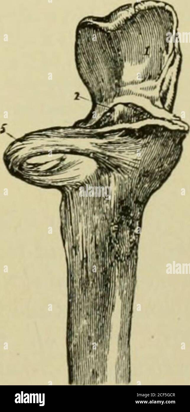 . Quains Anatomieelemente. Der Ulna wird mittels Fibro-Knorpel, Synovialsac und einigen verstreuten liLamentösen Fasern vorne und hinten bewirkt.der dreieckige Fibro-Knorpel ist eine dicke Platte, die durch ihre Basis an der Grenze befestigt ist, die den Karpal von der ulnar artikulierenden Oberfläche des Radius trennt; Und durch seinen Apexto eine Depression an der Wurzel des Styloid-Prozesses der Ulna, und an der Außenseite dieses Prozesses. Seine obere Oberfläche schaut in Richtung der Ulna, seine untere in Richtung zum Lunarbone, und es sef)arat(.S die inferiore Radio-ulnar Artikulation vom Handgelenk. Thesynovial sa Stockfoto