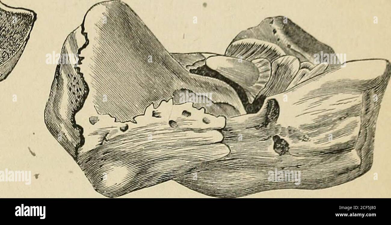 Inner condyle -Fotos und -Bildmaterial in hoher Auflösung – Alamy