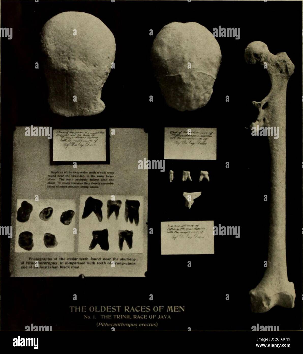 . Broschüre. Abb. 3. Obere Prämolaren und erste und zweite obere Molaren von fossilen Menschen-apeAustralopithecus. Nach Dem Besen. Durch den letzten Teil des Alters der Säugetiere war der vormenschliche Bestand wahrscheinlich in mehrere verschiedene Arten zerbrochen worden, von denen einige rückständiger waren, andere progressiver in Richtung zu den höheren Arten.. PITHECANTHROPUS; DER APE-MANN VON JAVA ABB. 4. (Schädeloberseite, Endokranialhöhle, Oberschenkel und Zähne. Die Etiketten sind in der Handschrift von Dr. Dubois, dem Entdecker dieses bemerkenswerten Exemplars, von dem diese Abgüsse präsentiert wurden, zu finden. Die Zähne gelten nun als gehörten t Stockfoto