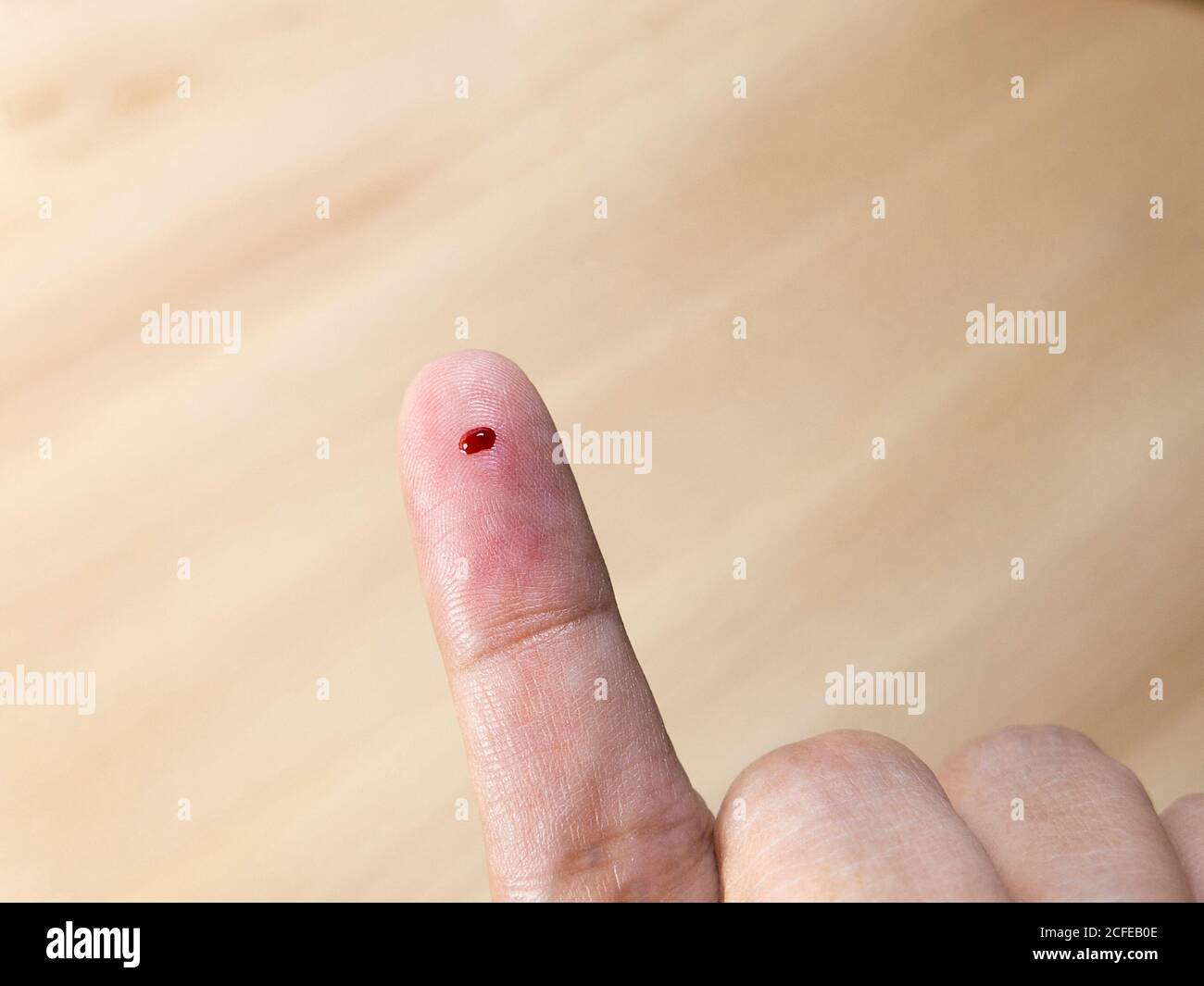 Nahaufnahme des weiblichen Fingers mit Blutstropfen für Blut Testen Stockfoto