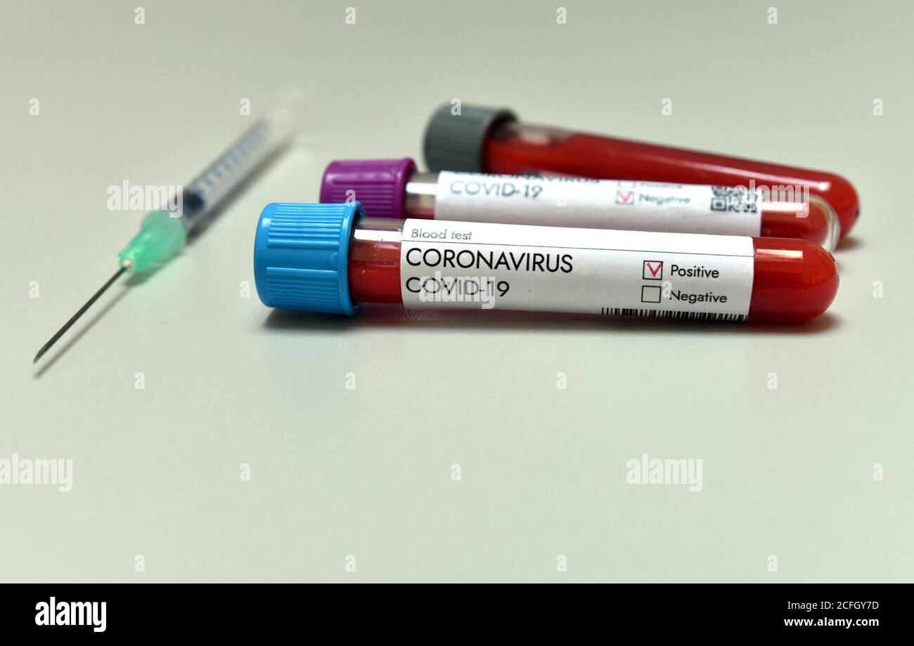 Coronavirus-Testblutprobe positives Ergebnis auf weißem Hintergrund. Coronavirus-Impfstoff. Stockfoto