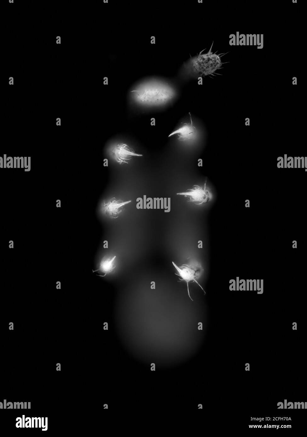 Collembola (Springschwanz) Füße unter dem Mikroskop Stockfoto