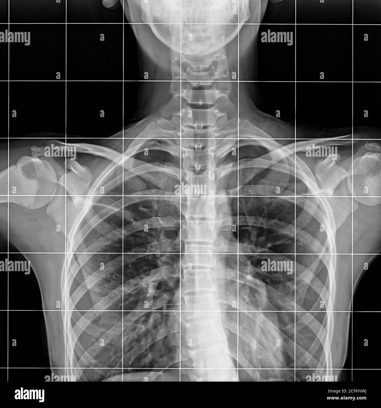 Röntgenaufnahme der Wirbelsäule des menschlichen Skeletts Stockfoto