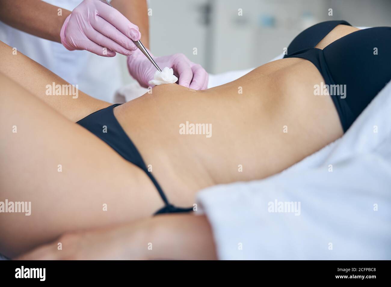 Dermatologe mit einem sterilen Gaze Pad während des medizinischen Eingriffs Stockfoto Dermatologe mit einem sterilen Gaze Pad während des medizinischen Eingriffs Stockfoto