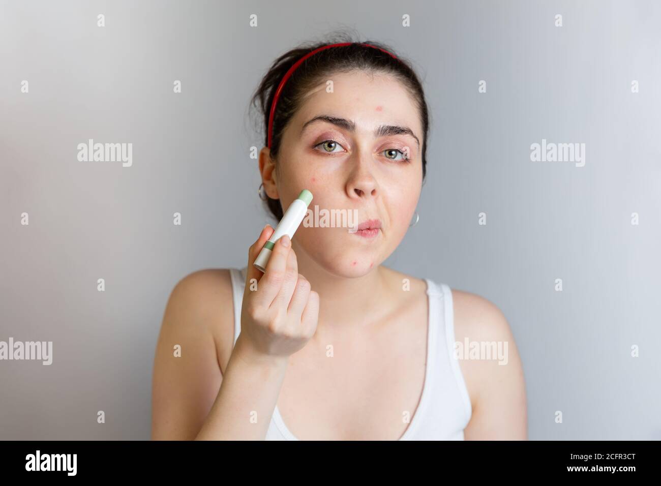 Ein niedliches Teenager-Mädchen verwendet einen Concealer Bleistift, um  einen Pickel auf ihrer Wange zu verdecken. Das Konzept der Kosmetologie und  Akne-Kontrolle, Adoleszenz. Speicherplatz kopieren Stockfotografie - Alamy