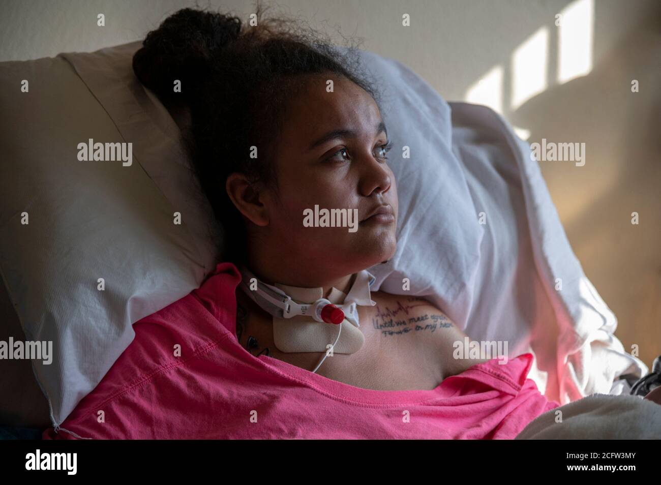 Sacramento, Kalifornien, USA. Februar 2020. FELICIA BRENT-VELASQUEZ, 18, sitzt im Februar in einem Krankenhausbett, während sie sich zu Hause von einem Autounfall erholt, bei dem sie eine Quadriplegikerin hinterlassen hat. Vor dem Unfall, als sie eine Bewohnerin des Kinderempfangsheims von Sacramento war, sagte sie, dass sie nur die Sicherheitskräfte bitten müsse, das Tor zu öffnen und sie würde direkt aus dem Haus gehen und ins AWOL gehen. Sie hat ein Tattoo auf ihrer Schulter für einen Jungen, mit dem sie in einer Beziehung war und der in Southside Park starb. Seine eingeschrieben mit einem Leben Puls schlagen, seinen Tag des Vergehens, und die Worte "bis wir wieder für immer in m treffen Stockfoto