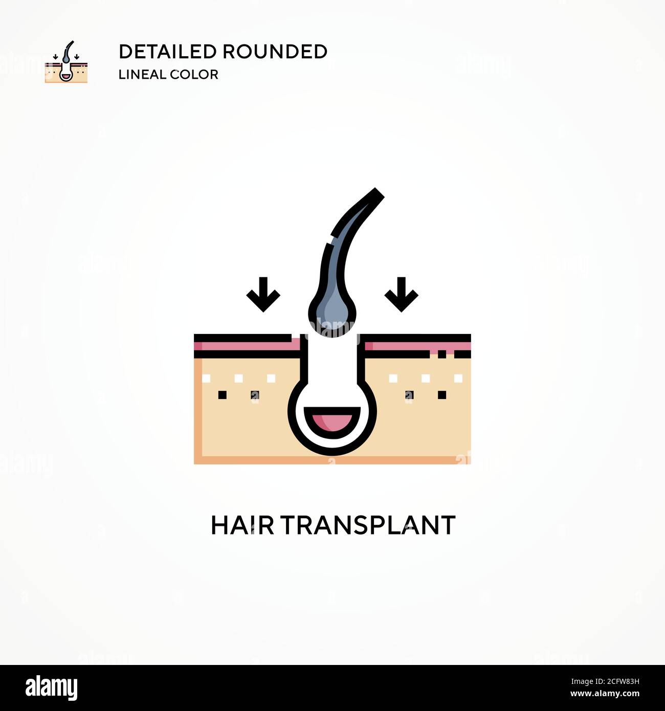 Vektorsymbol für Haartransplantation. Moderne Vektorgrafik Konzepte. Einfach zu bearbeiten und anzupassen. Stock Vektor
