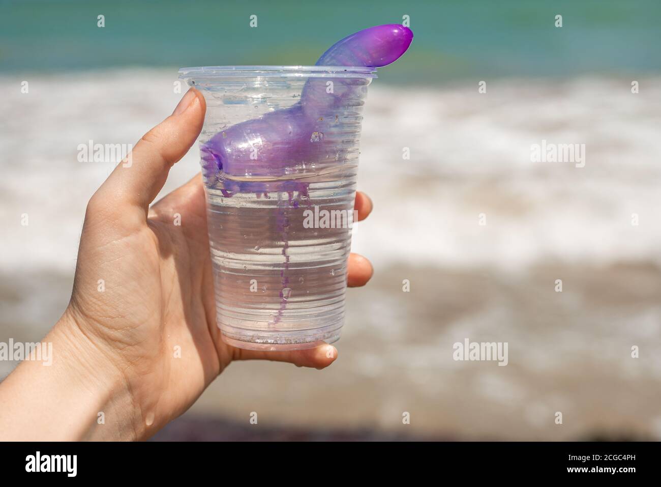 Menschliche Hand zeigt einen Plastikbecher mit einer stechenden Marine bluebottle Stockfoto