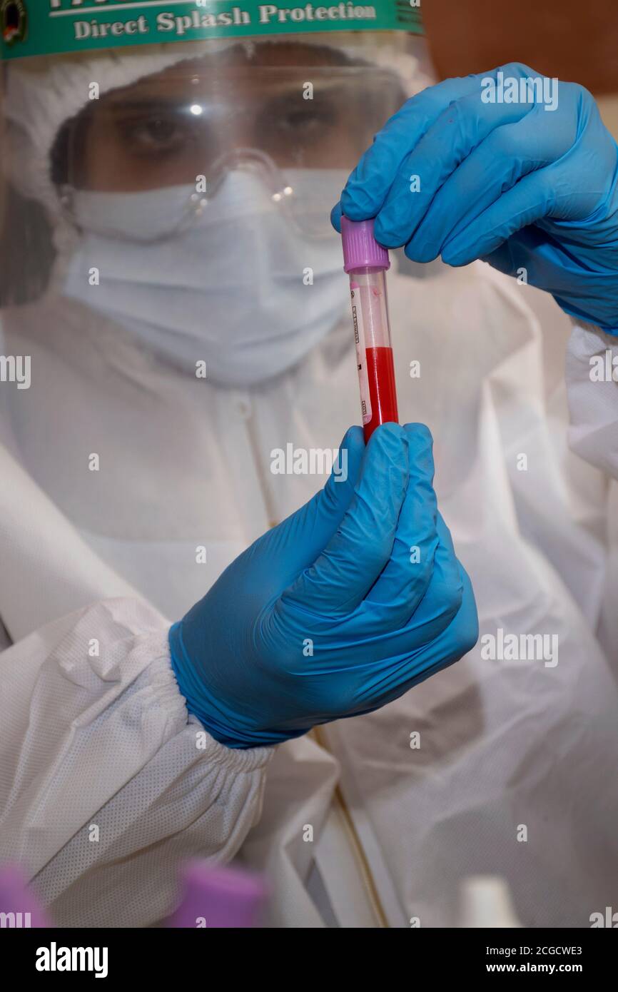 Krankenschwester des weiblichen Arztes, die das Blutergebnis des Coronavirus Testsatzes hält Stockfoto
