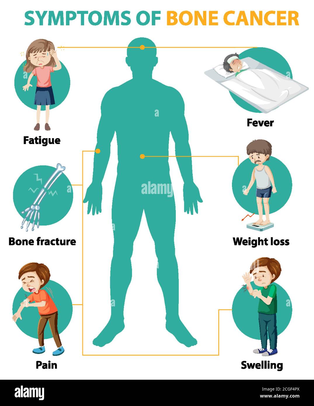 Medizinische Infografik der Knochenkrebssymptome Illustration Stock