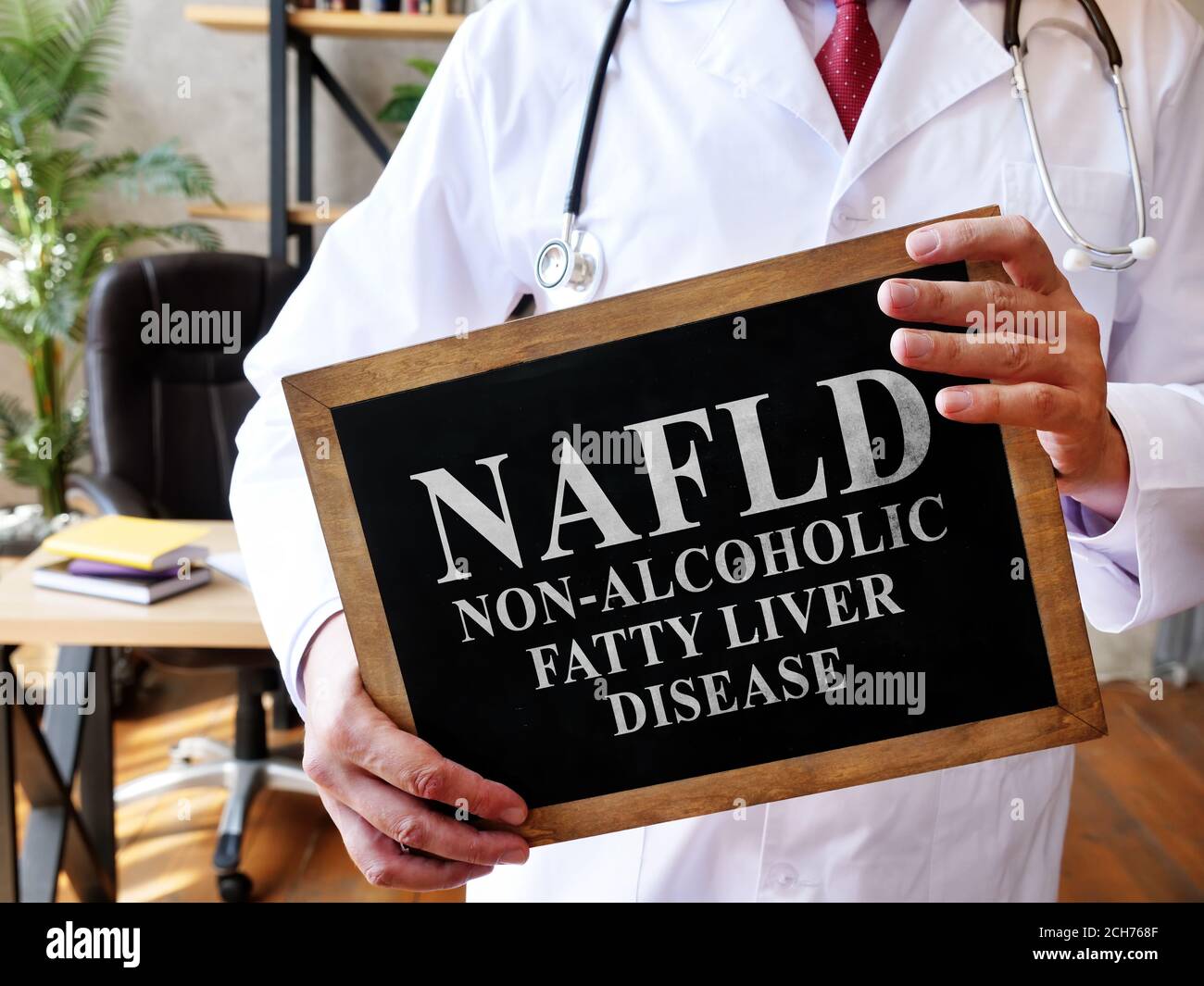 Nicht-alkoholische Fettlebererkrankung NAFLD der Arzt hält ein Zeichen. Stockfoto