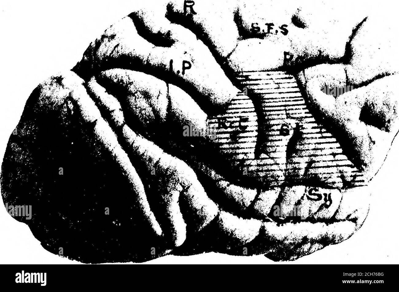 . Eine weitere Minutenanalyse durch elektrische Stimulation der sogenannten motorischen Region (Gesichtsbereich) des Cortex Cerebri im Affe (Macacus sinicus) . ng über der Zunge auf der Längsachse mit dem Dorsum zur Wange der Längsseite gerichtet; Die nach vorne und nach unten abfallenden Linien bezeichnen das Vorliegen der Zunge gerade; die nach unten und nach hinten gerichteten Linien bezeichnen das Zurückziehen der Zunge. Fisf. 10 zeigt die Lokalisation der Darstellung der Bewegung des Vorsprüngen der Zunge gerade. Abb. 11 zeigt die Lokalisation des Vorwölbung der Tongu Stockfoto