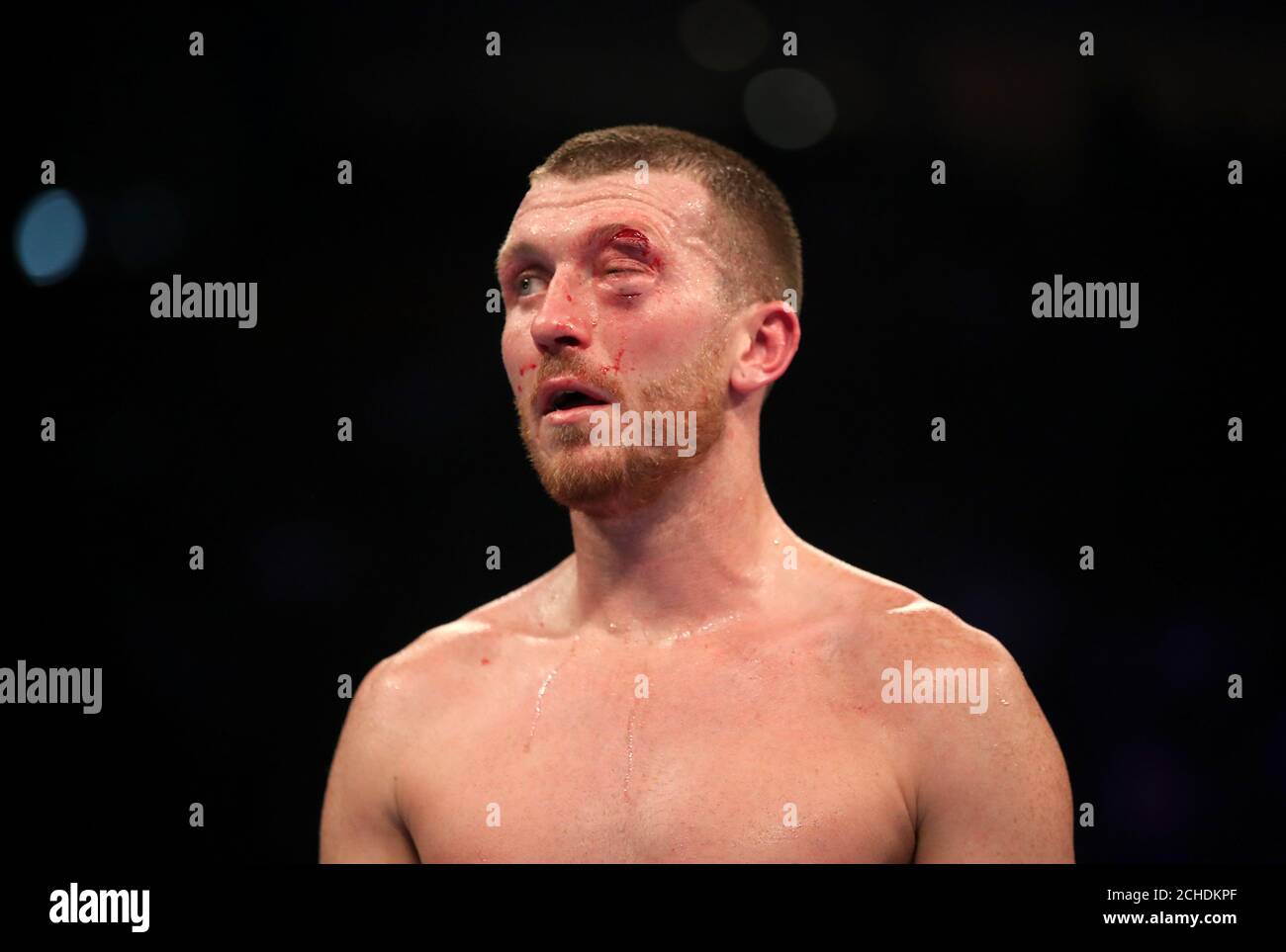 Scott Cardle mit einem Schnitt über dem Auge nach der Niederlage von Ricky Burns in ihrem Lightweight Contest in der Manchester Arena. Stockfoto