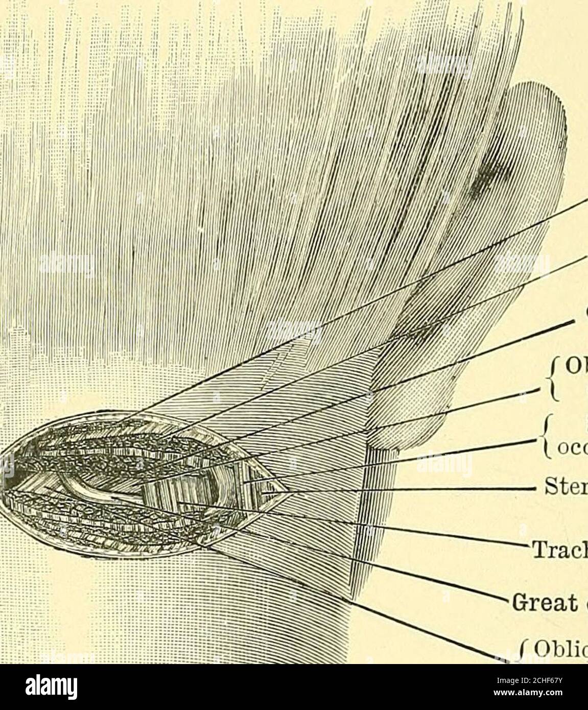 . Textbuch der operativen Chirurgie . Trapez.Splenius capitisComplexus. f obliquus(  capitis inf. / klein(, Okzipital n. Sterno-Mastoid. Traclielo-mastoid.Great occipital Il r obliquus capitist sup. Abb. 116.- -Ligatur der Arteria occipitalis aud Exposition des kleinen Nervus occipitalis.großer Nervus occipitalis. Nach dem Teilen der Aufsätze des Levator anguli scapula? Zu den Transverseprozessen (und dem Vorziehen des Muskels) sehen wir den kurzen starken Bauch des Theobliquus capitis inferior, um dessen äußeren Rand sich der große Hinterhauptnervenaufhänger befindet. Dem Nerv folgend finden wir seinen Ausgang A Stockfoto