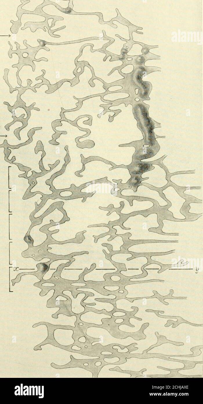 . Das amerikanische Journal of Anatomy . 4 ^. DAS AMERIKANISCHE JOTJRNAL DER ANATOMIE, VOL. 13, NR. 2 115 IK) JOHN LEWIS BREMER regelmäßig, und die Maschen sind etwas kleiner, vor allem nach dem Kopf. Genauere Untersuchung wird zeigen, dass jede Schnur verlängert sich von der lateralen Herz fast direkt in Richtung der Medianlinie, dann plötzlich breitet sich längs, als ob seine weitere Richtungsverlauf durch eine Obstruktion blockiert wurden. An allen, bis auf zwei Stellen, die durch die Pfeile markiert sind, haben sich die Längsstränge des thismesialen Netzes mit anderen anastomosiert; an diesen beiden stellen wird das Längsnetz unterbrochen, ein Stockfoto