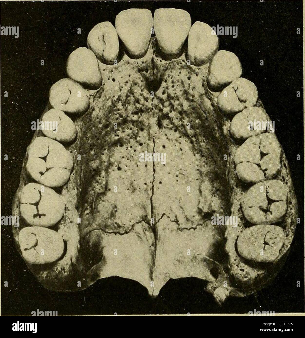 . Operative und zahnärztliche Anatomie Technik; ein Klassenzimmer und Labor Handbuch für Anfänger Zahnärzte Studenten . Abb. 2. – Okklusion der Zähne. Seitenansicht. Des Bogens in den sanguinen, bärigen, nervösen und lymphatischen Temperamenten. B. Abb. 126, Abs. 187 bis 188. B. F. S.11, 78, ^Z-4. Untersuchen Sie die Okklusion der Zähne (Abb., i und 2). B. Par.190. B.F. S. 85 bis 90. ^ DENXAjL ANATOMIE unterscheidet den Unterschied zwischen Okklusion und Artikulationsfunktion. B.F. S. 85 und 86. Unterscheiden Sie zwischen dem interproximalen Raum und der interproximalen Embrasure. B. Abs. 13, 193 und 194.Studium der Formel für die permanente Stockfoto