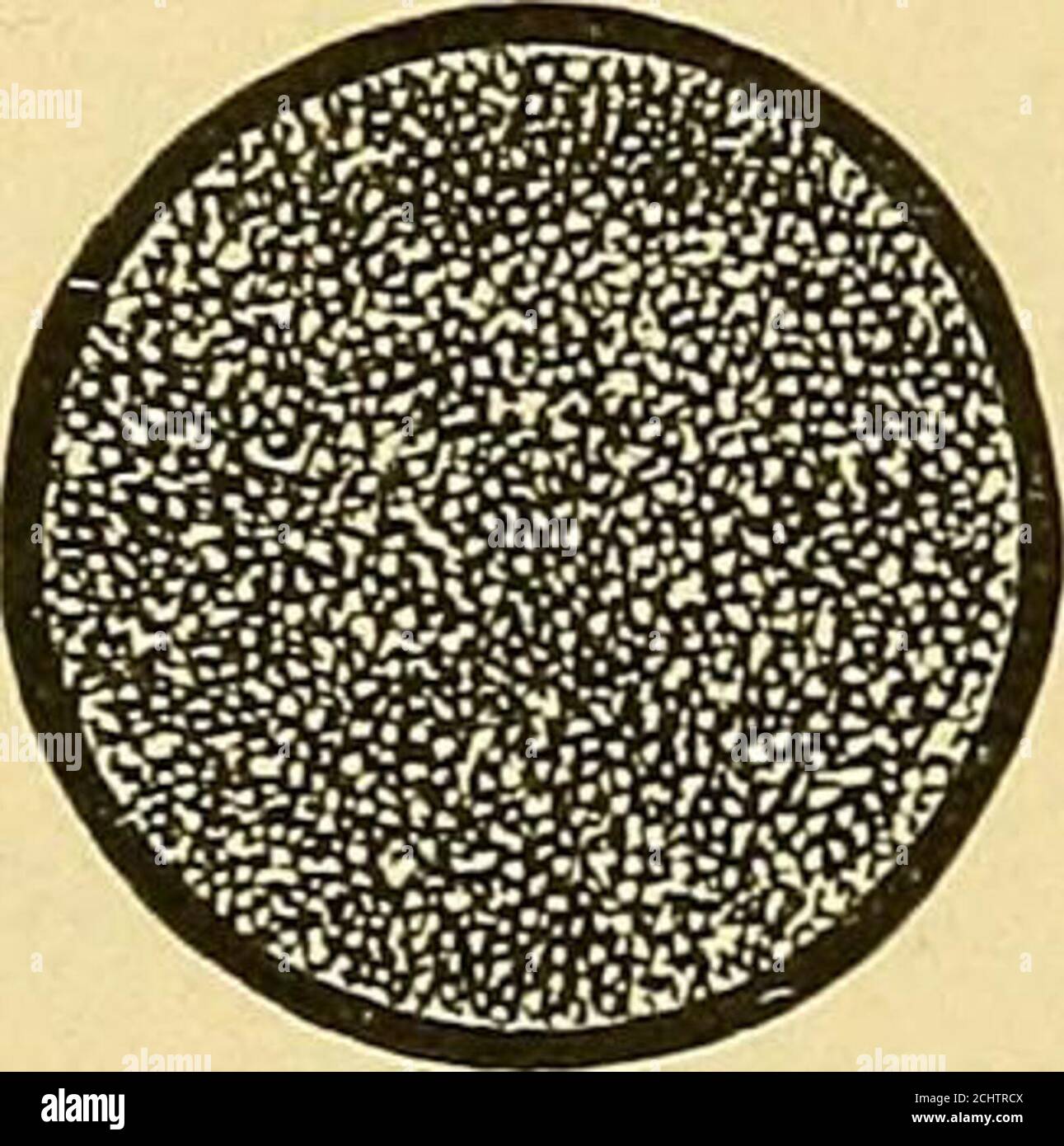 . Die Behandlung von Krankheiten durch elektrische Ströme : ein Handbuch von einfachen Anweisungen für den Hausarzt . Abb. 230. Feine Filz- oder schwammbedeckte Elektrode – verschiedene Größen mit weichen Gummidämmrückseiten. Auf ein Pint heißes Wasser drücken Sie sie mäßig trocken und legen sie unter die untere Wirbelsäule, wobei der Patient in der Rückenlage liegt. Schützen Sie die Kleidung des Patienten mit zusammenklappbaren Tüchern außerhalb der Elektrode. Beschaffen Sie sich eine runde Handelektrode, etwa drei Zoll Durchmesser, deren Basis entweder Kohlenstoff oder Metall sein kann. 558 ELEKTRISCHE BEHANDLUNG VON MYOMEN. Abb. 231. Filz oder s Stockfoto
